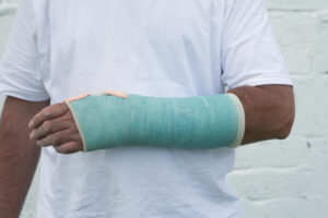Close up of a man in a white t-shirt showing off his newly-broken wrist.